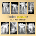 Picture of Endo Arch Gold Pro Rotary Files