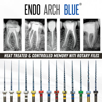 Picture of Endo Arch Blue NiTi Rotary Files